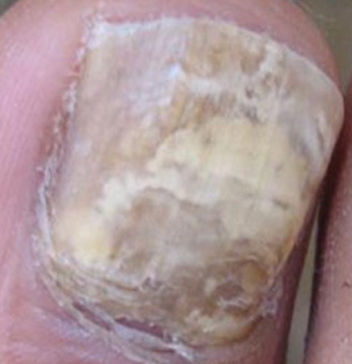 ��ָ�׻ᴫȾ������