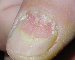 ��ָ�׻᲻������