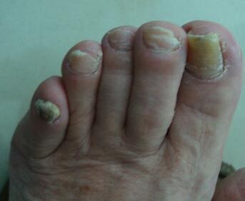 �ѻ�ָ�׼��ɾ������