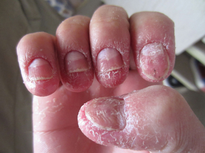 ϴ���ܴ�Ⱦ��ָ��ô