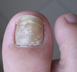 ��ָ�������˻�����