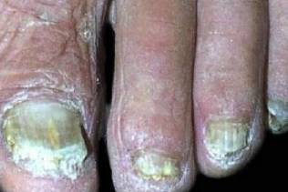 ��ָ�״�ȾӤ��