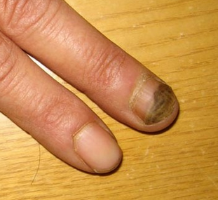 ��ָ���ܴ�Ⱦ��Ӥ����