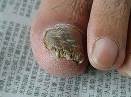 ��ָ�׻᳤�ڽ�����