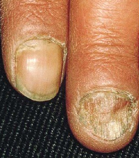 �л�ָ����ʲô�ݽ�