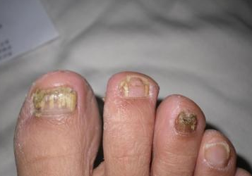 ���˻�ָ�����κ���