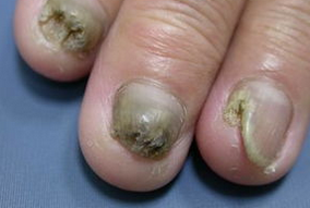 ��ָ�״����ٶȿ���