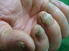 ��ָ�׳����ܷ����