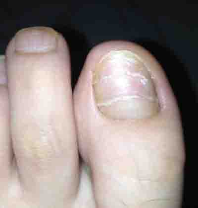 ��ָ�׺��˻���Ⱦô