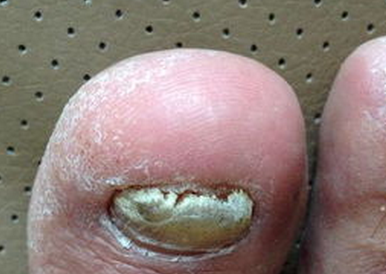 ��ָ�׻᲻�ᴫȾ