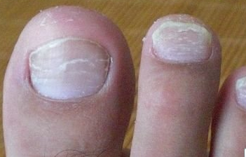 ��ָ����ʲô֢״����