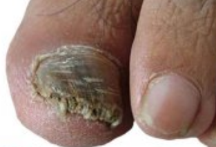 ��ֺ��ָ��֢״