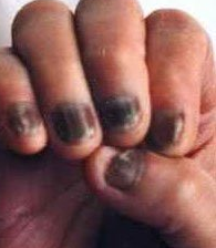 ��ָ��֢״����