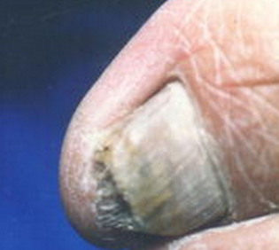 ��ָ��֢״����