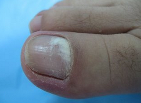 ��ָ���ٴ�֢״