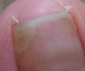 ��ָ�����֢״