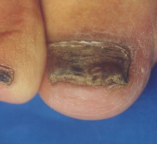 ��ָ��֢״��ɶ