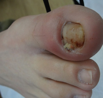 ���Ƽ׹��׵�ҩˮ