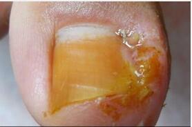 ��ҩ�μ׹��׵���ѿ