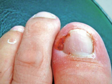 ���Ƽ׹���ƫ��