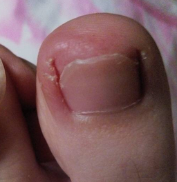 ��û�����Ƽ׹��׵�ҩ