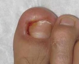 ���Ƽ׹���Ƕ��