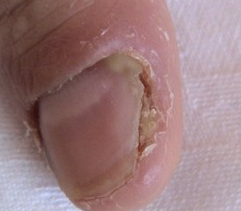 ������ȼ׹���