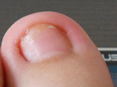 ���Ƽ׹����ò�����ҩ