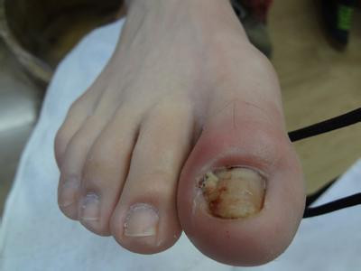 �޽ŵ����μ׹�����