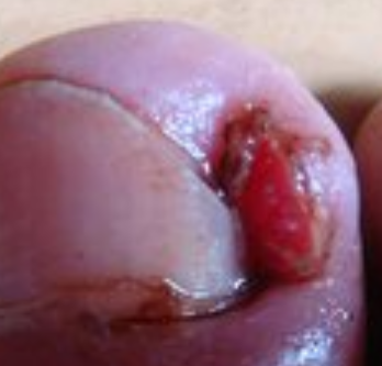 �޽ſ������Ƽ׹���