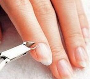 指甲花能治疗甲沟炎吗 指甲花能治疗甲沟炎吗