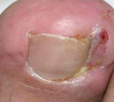 ���صļ׹�����ô���Ʒ���