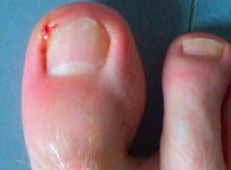 ���ڼ׹��׵���ҩ