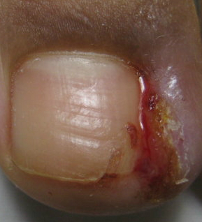 ��ô�κü׹���