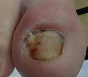 ���Ƽ׹������İ취