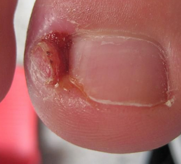 Ӥ�����ϼ׹�����ô��