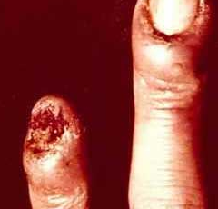 ����׹�����ô����