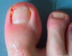 ���Ƽ׹�����÷���