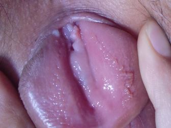 点击查看源网页