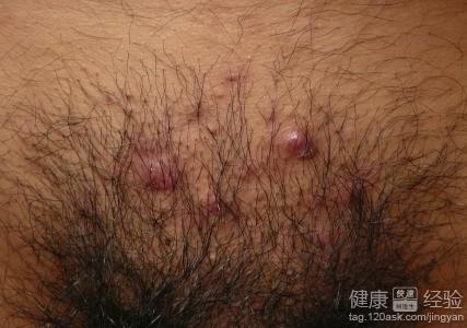 ��ë���׵Ĳ����ڸ�Ů����ʲô����ҩ�ã���ҩ���α���