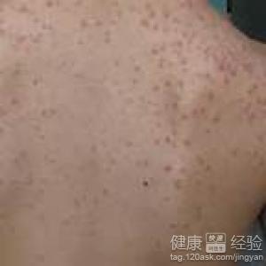 第1步