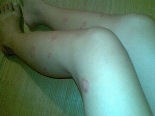 <a href=/npx/ target=_blank class=infotextkey><a href=/npx/ target=_blank class=infotextkey>ţƤѢ</a></a>����