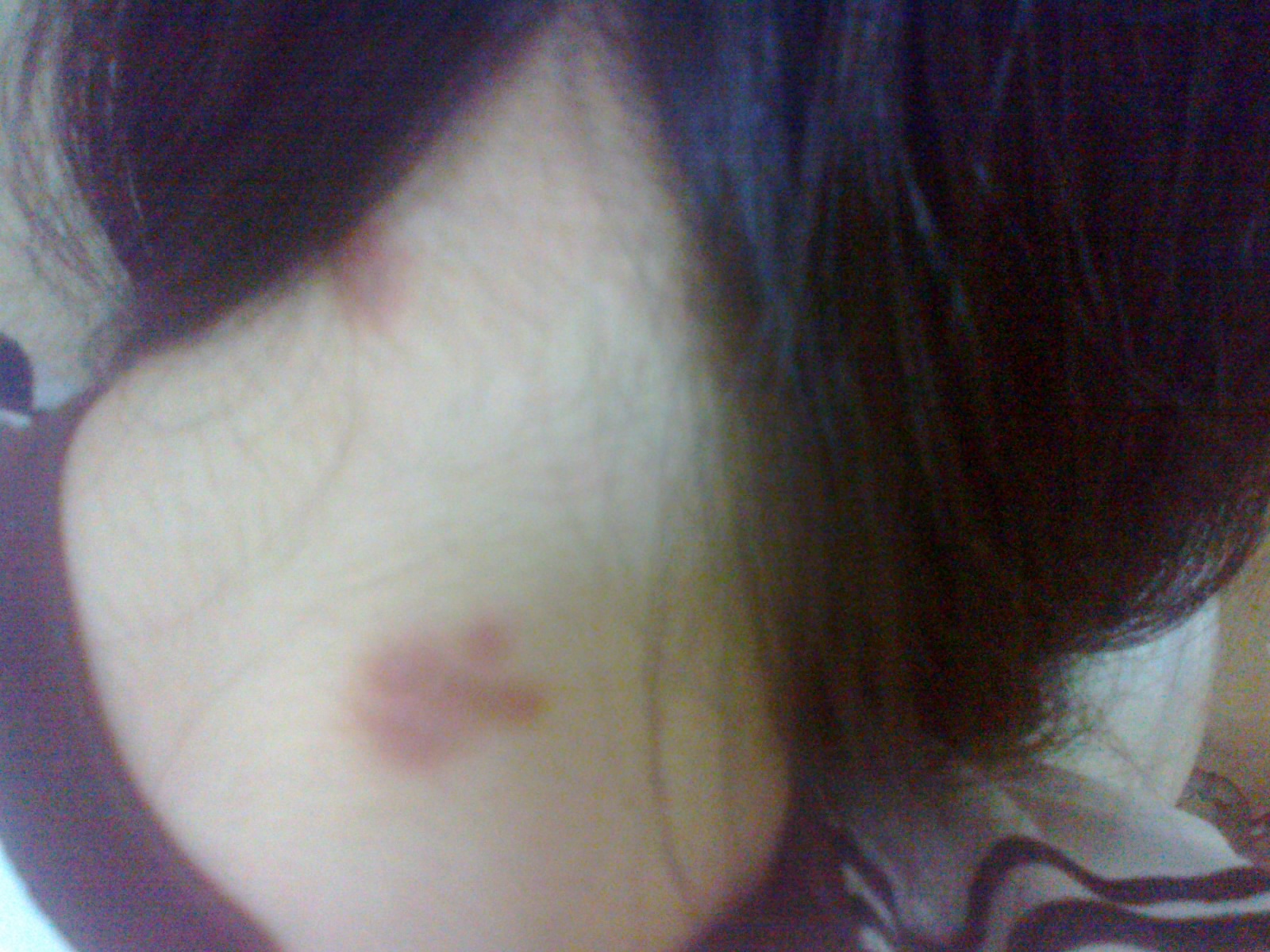 看牛皮癣哪里比较好