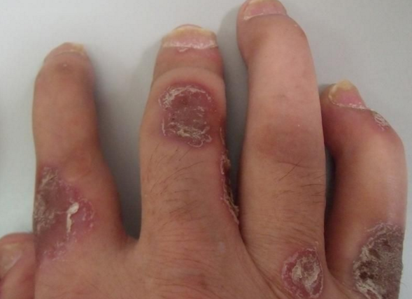 �����˿ڻ᲻���շ�<a href=/npx/ target=_blank class=infotextkey><a href=/npx/ target=_blank class=infotextkey>ţƤѢ</a></a>