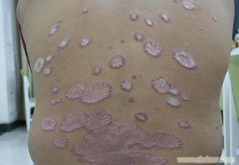 <a href=/npx/ target=_blank class=infotextkey><a href=/npx/ target=_blank class=infotextkey>ţƤѢ</a></a>ƻᵼӪ