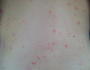 ��<a href=/npx/ target=_blank class=infotextkey><a href=/npx/ target=_blank class=infotextkey>ţƤѢ</a></a>���Ĵ����ԭ��