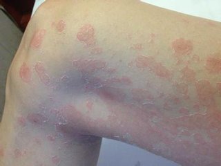 <a href=/npx/ target=_blank class=infotextkey><a href=/npx/ target=_blank class=infotextkey>ţƤѢ</a></a>�Ĳ�����ʲô�����