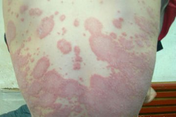 ŧ����<a href=/npx/ target=_blank class=infotextkey><a href=/npx/ target=_blank class=infotextkey>ţƤѢ</a></a>��������ô������.