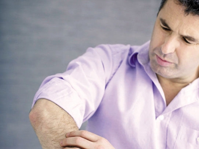 Ԥ��ţƤѢ�����ķ�������Щ