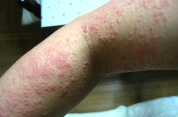 ��Щ�����շ���ʪ��